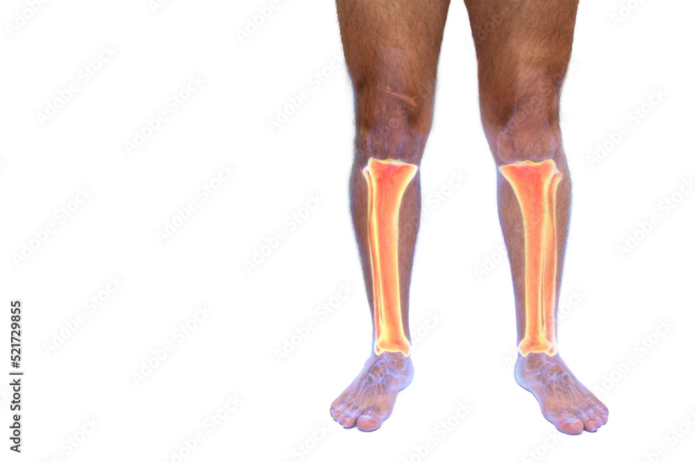 Transparent view of fibula, tibia and foot bones of a man on white ...