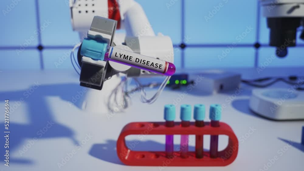 Lyme Disease Robot and a test tube with a blood sample for microbiological analysis in the robot's hand. Futurological concept of medicine of the future