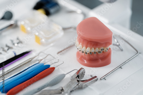 Tooth model with metal braces lying on a dental table with instruments photo
