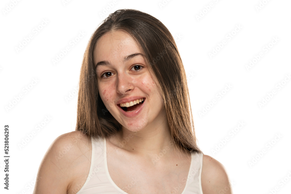 beautiful young smiling women with problemati skin. beautiful young smiling women with problemati skin.