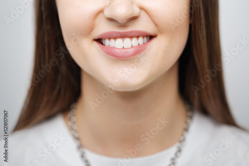 Happy caucasian female smile with white teeth isolated on white