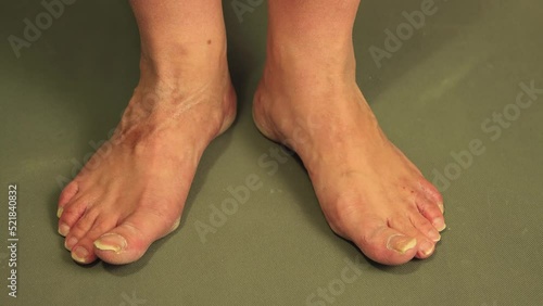 Men's feet stand on the floor with long nails and wiggle their thumbs. Keratinization and thickening of the epidermis in the soles of the feet. Foot care concept. Isolated video, close-up. UHD 4K. photo