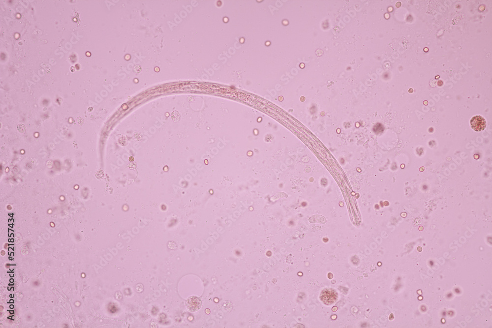 View in microscopic Strongyloides stercoralis or threadworm in human stool.Parasite infection
