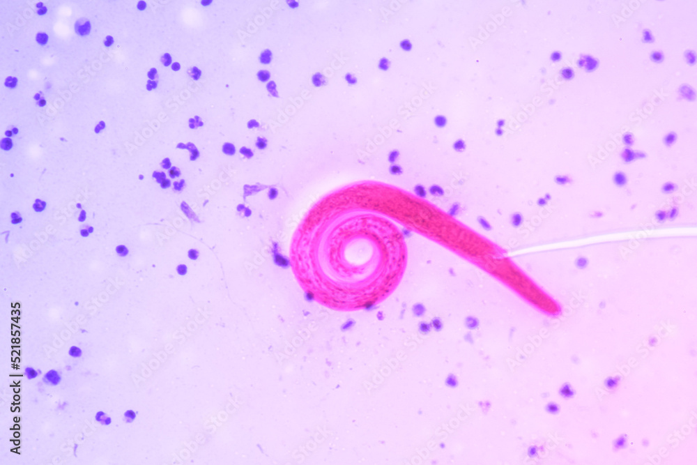 View in microscopic Strongyloides stercoralis or threadworm in human