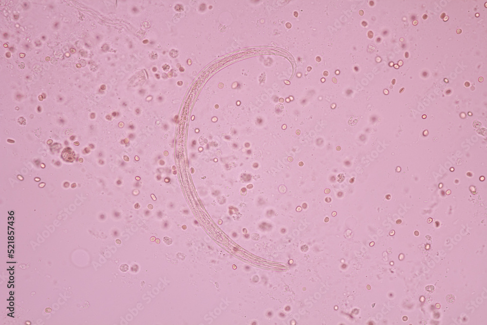 View in microscopic Strongyloides stercoralis or threadworm in human
