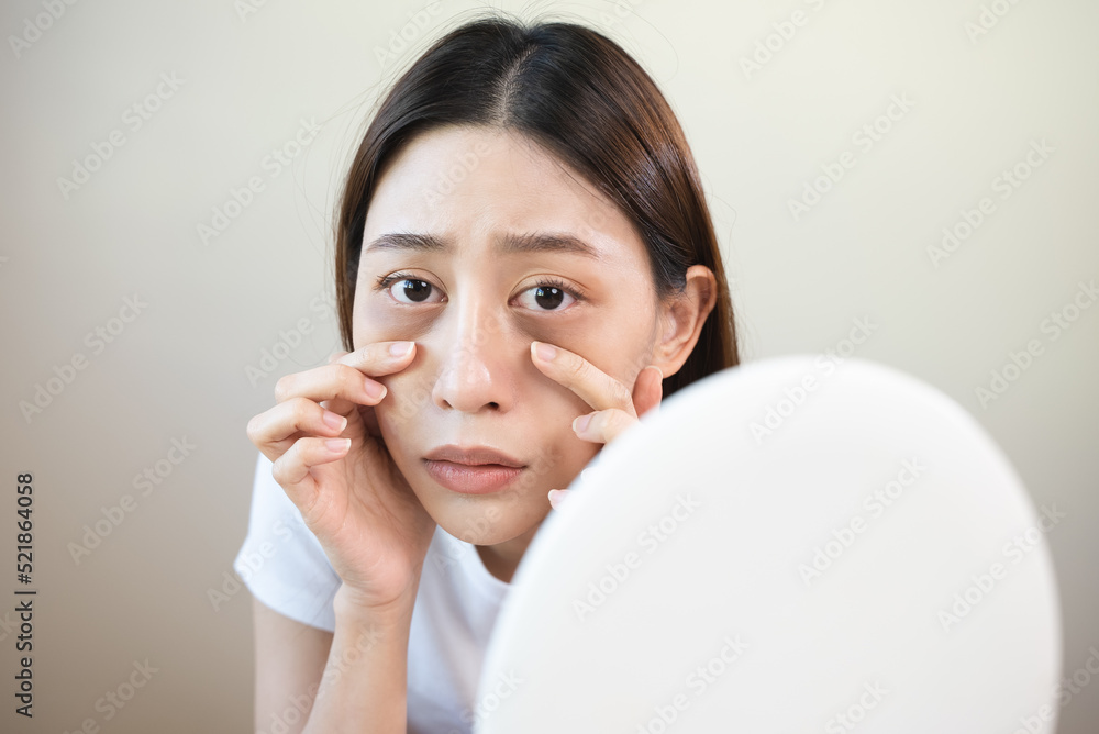 Sleepless Asian woman looking her face in the mirror and worry about dark circles under eyes Sleepless Asian woman looking her face in the mirror and worry about dark circles under eyes