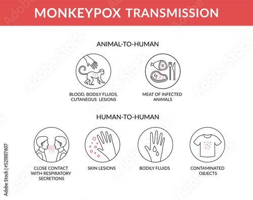 Transmission of the monkey pox virus infographic. This causes skin infections. Outline vector illustration

