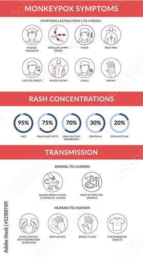 Monkeypox virus symptoms, transmission and rash concentration. Outbreak of infection from monkey infographic.  Linear vector illustration