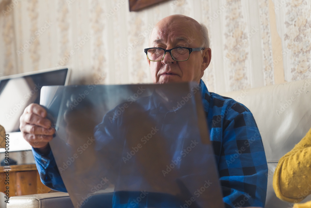 Fototapeta premium Concerned, shocked and confused old caucasian grey-haired man looking at his lungs x-ray results and worrying about his diagnosis while sitting on a beige leather sofa at home. High quality photo