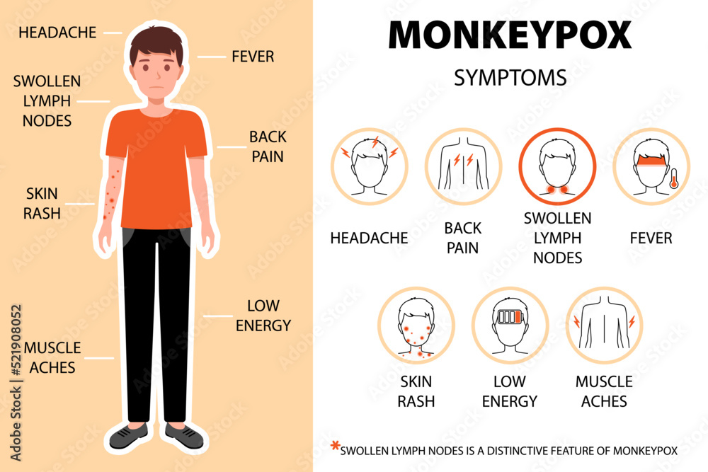 Monkeypox Virus Symptoms Infographic With Man Headache Back Pain Monkeypox Virus Symptoms Infographic With Man Headache Back Pain
