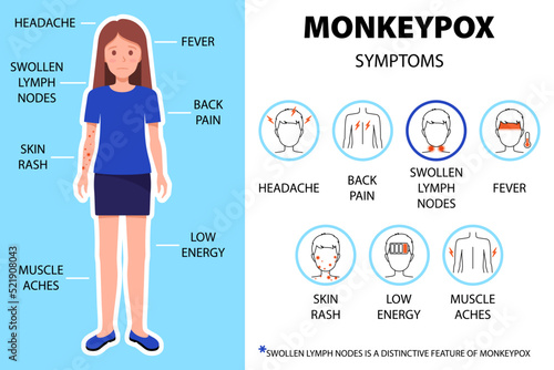 Monkeypox virus symptoms infographic with woman. Headache, back pain, swollen lymph nodes, fever, skin rash etc. Headache, back pain, etc. New outbreak cases in Europe and USA.