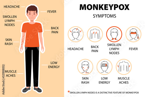 Canvas Print Monkeypox virus symptoms infographic with man