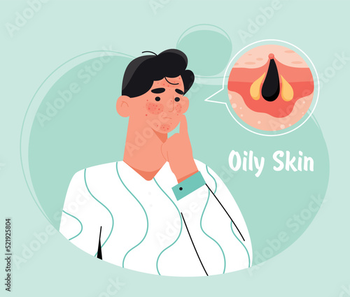 Oily skin concept. Poster or banner for advertising cosmetics, diseases and problems. Paren touches pimples on his face. Conditions, anatomy, body and skincare. Cartoon flat vector illustration