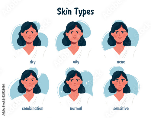 Skin types woman. Advertising of cosmetics, dermatology and treatment of diseases. Hygiene and beauty, care for appearance. Oily, dry, acne and combination type. Cartoon flat vector illustration