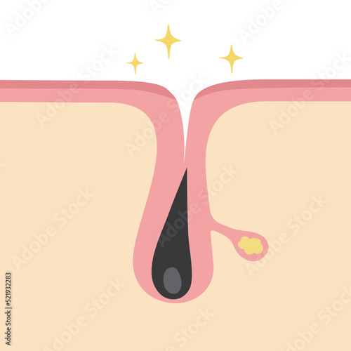 キレイな毛穴のイメージ