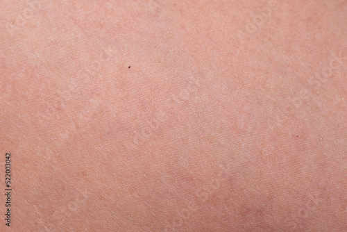texture texture human skin close-up pink white abstract background human skin concept
