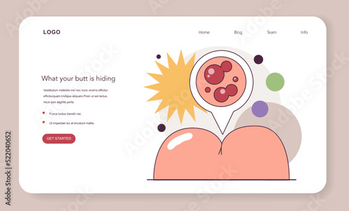 Hemorrhoids web banner or landing page. Rectum inflammation