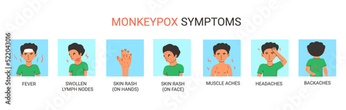 Monkeypox virus symptoms set. Vector medical infographic