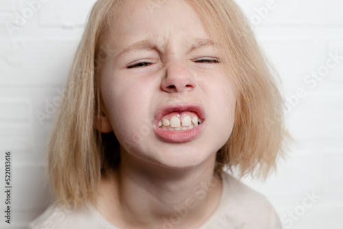 Girl shows teeth with a gap, malocclusion