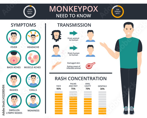 Monkeypox virus information concept. Pox virus, fever, headache, swollen lymph nodes, back ache, rashes.