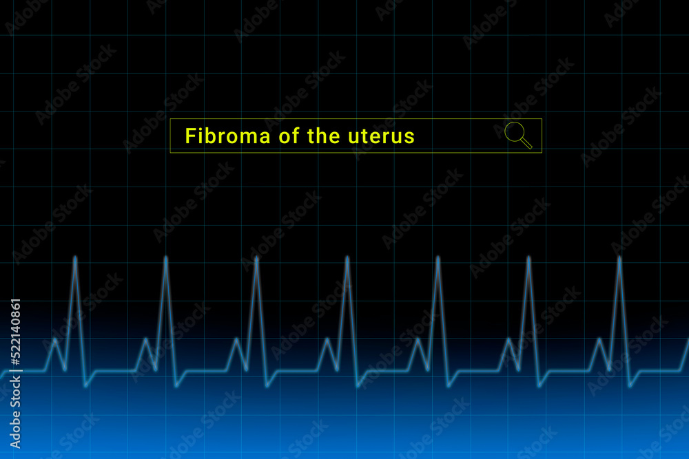 Fibroma of the uterus.Fibroma of the uterus inscription in search bar. Illustration with titled Fibroma of the uterus . Heartbeat line as a symbol of human disease. Fibroma of the uterus.Fibroma of the uterus inscription in search bar. Illustration with titled Fibroma of the uterus . Heartbeat line as a symbol of human disease.