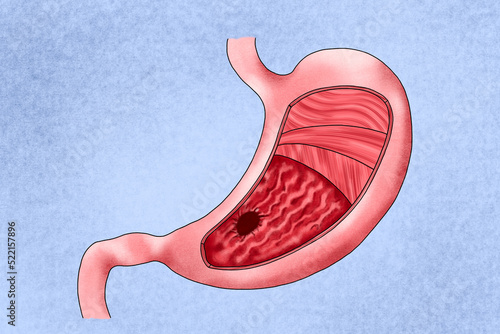 Human stomach photo