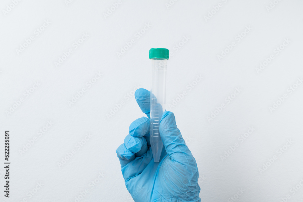 vacuum tube for collection and blood samples in blue gloves for laboratory. vacuum tube for collection and blood samples in blue gloves for laboratory.