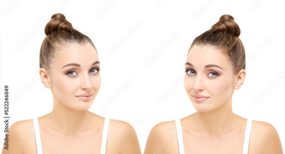 Alopecia Areata,female pattern baldness,Treatment for hair loss,Hair transplant,Surgery to implant artificial hairs Alopecia Areata,female pattern baldness,Treatment for hair loss,Hair transplant,Surgery to implant artificial hairs