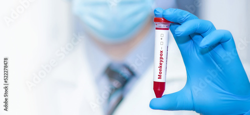 Fotografie Doctor holding a test blood sample tube with monkey pox virus (MPXV)