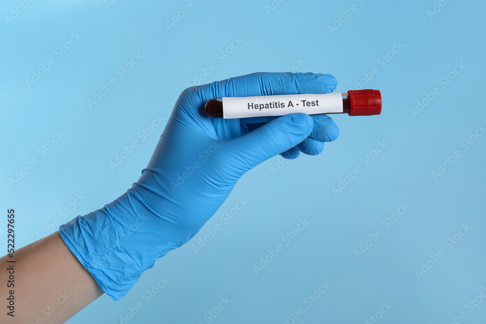 Obraz premium Scientist holding tube with blood sample and label Hepatitis A Test on light blue background, closeup