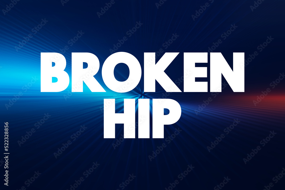 Broken hip text quote, medical concept background Broken hip text quote, medical concept background