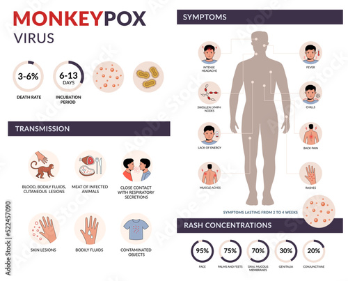 Monkeypox virus transmission, symptoms, rash concentration vector infographic with icons. Infection spreading from monkey. Flat design