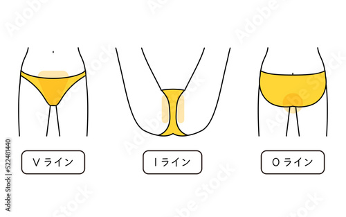 女性の脱毛イラスト　VIO