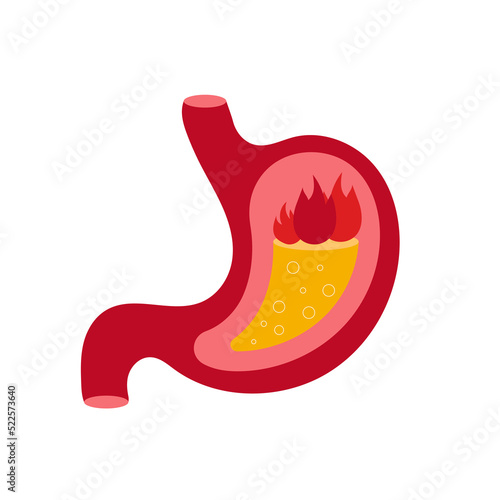 Illustration of severe pain and heartburn in the stomach.