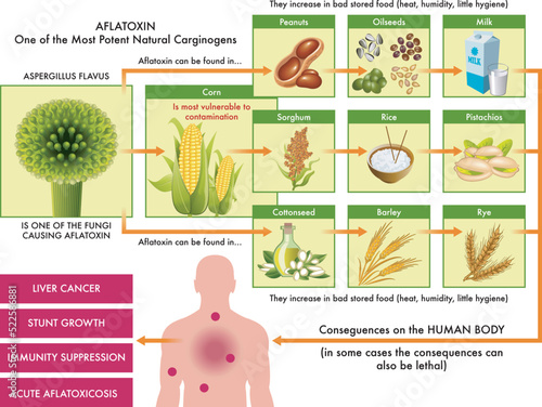Medical diagram of the main foods that can be contaminated with aflatoxin, one of the most potent carcinogens found in nature, and the possible consequences on the human body, with annotations. photo