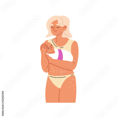 Young mother with stretch marks on her body. Newborn baby in arms. Self love concept. Flat vector illustrations