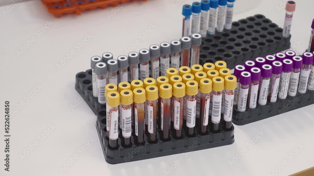 Blood Sample Tubes For Medical Analysis Placed On Tray In Laboratory. Using Blood Samples In Tubes For Medical Examination. Doctor Inserts Sample Tubes Into Tray. Blood Test. Healthcare. Biochemistry Blood Sample Tubes For Medical Analysis Placed On Tray In Laboratory. Using Blood Samples In Tubes For Medical Examination. Doctor Inserts Sample Tubes Into Tray. Blood Test. Healthcare. Biochemistry