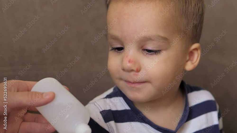A caring mother applying antiseptic cream to a scratch and a bump on her son's nose. A little boy was running on a playground on a hot summer day and fell. A caring mother applying antiseptic cream to a scratch and a bump on her son's nose. A little boy was running on a playground on a hot summer day and fell.