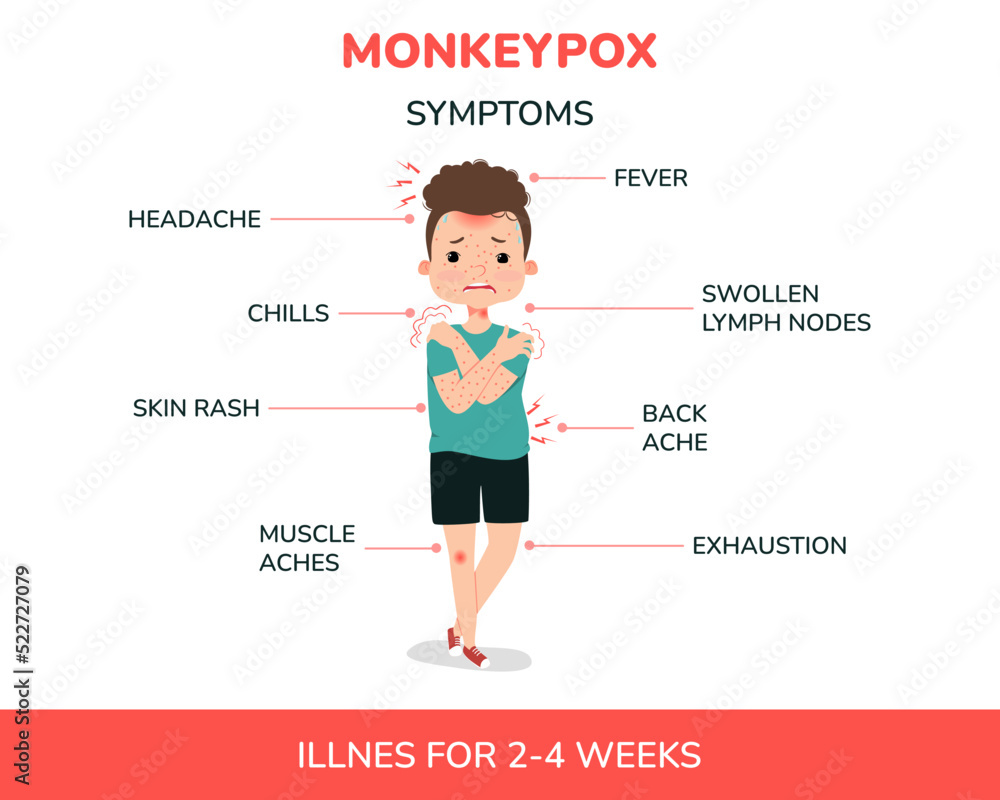 A boy with monkeypox and the symptoms illustration. Fever, headache