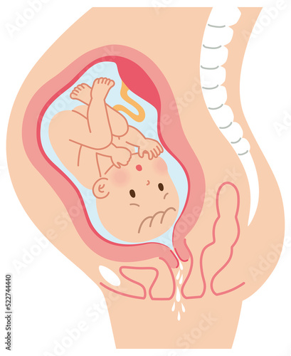 前期破水 子宮の中の赤ちゃん 妊娠中の母体の仕組み