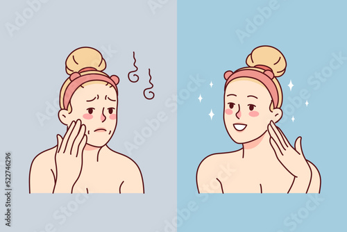 Woman before and after beauty face procedures. Unhappy female satisfied with cosmetology treatment result. Vector illustration. 