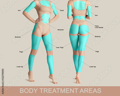 Poster with female body with marked areas for lifting procedures. Base fat problems areas of human body. photo