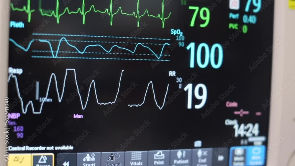 Electrocardiogram Heart Rate machine in hospital showing pulse and