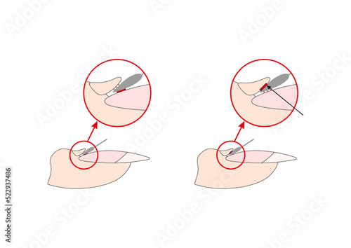 Nails cuticle instruction guide. Cutter manicure instrument. Tutorial.