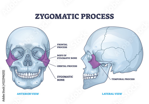 Zygomatic process as human cheek bone skeleton anatomy outline diagram. Labeled educational cheekbone location and skull parts structure vector illustration. Frontal, orbital and temporal process.