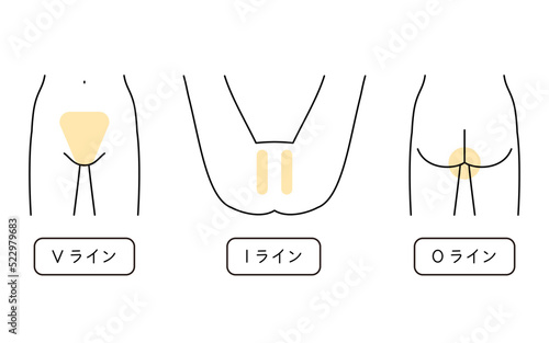 女性の脱毛イラスト　VIO