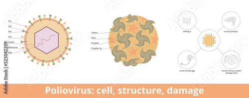 Poliovirus: cell, structure, damage. Viral cell: RNA genome and a protein capsid, glycoproteins. Main pathophysiology characteristics: settling in stomach, nerve cell damage, and muscle paralysis.