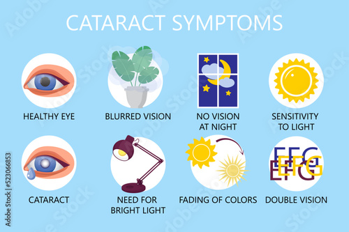 Cataract symptoms ingographic concept vector. Glaucoma disease and nephropathy problems. Ophthalmologist