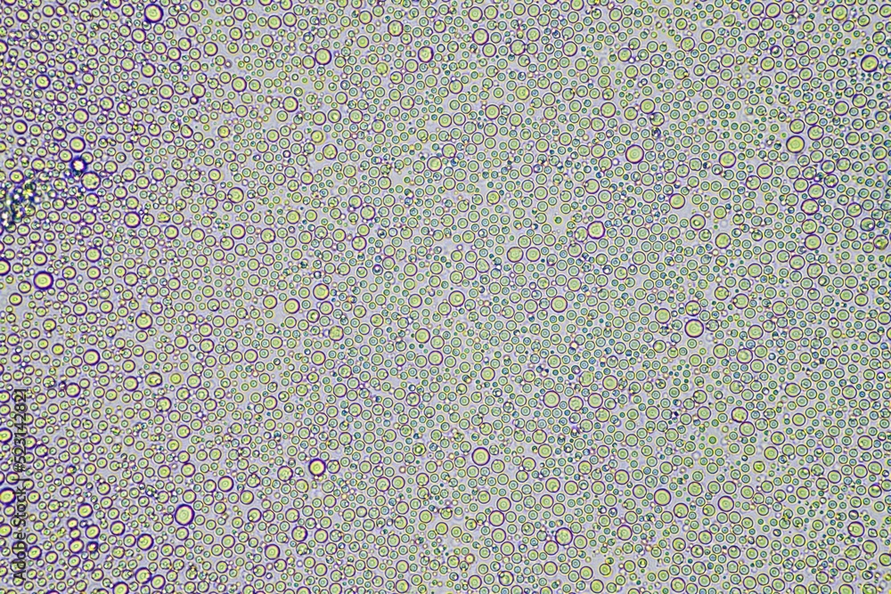 person with a virus coughing, Phlegm and mucus under the microscope person with a virus coughing, Phlegm and mucus under the microscope