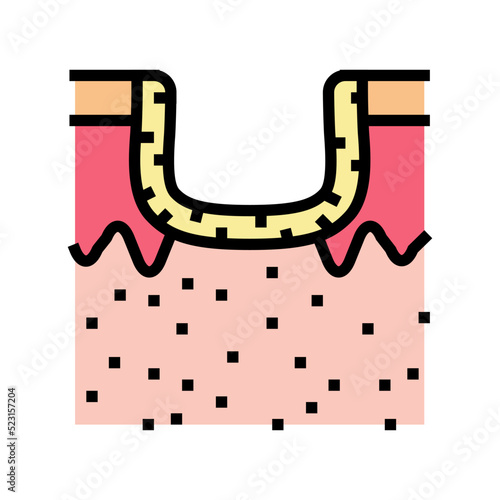 hypertrophic acne scar color icon vector. hypertrophic acne scar sign. isolated symbol illustration